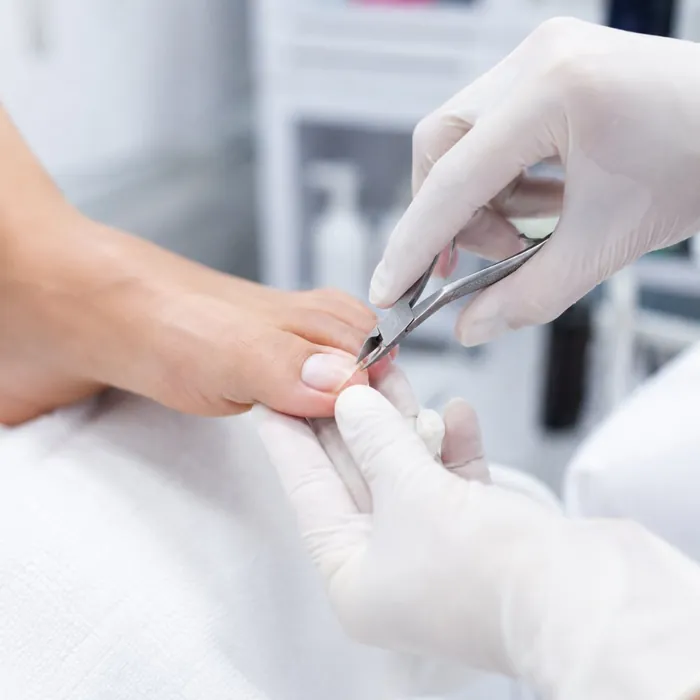 Podoprofilaxia e cuidado preventivo dos pés